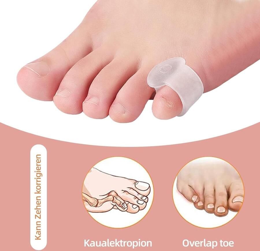 4-delige gel-teentrainer voor bal- en hamertenen corrigerende teenslippers voor pijnverlichting en drukverlichting
