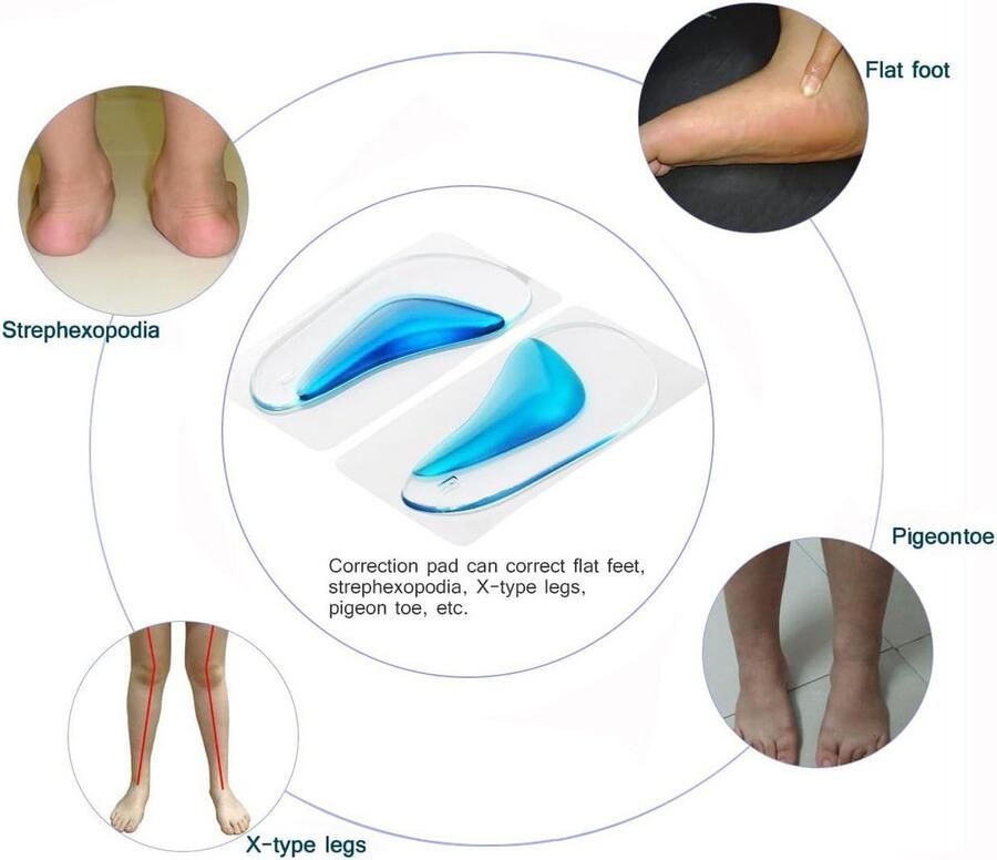 4 paar platte voetboogondersteuning inlegzolen siliconen gel correctie voor schoenvoeten inlegzolen correctie pads boog steunkussens voor platte voeten professionele corrector blauw