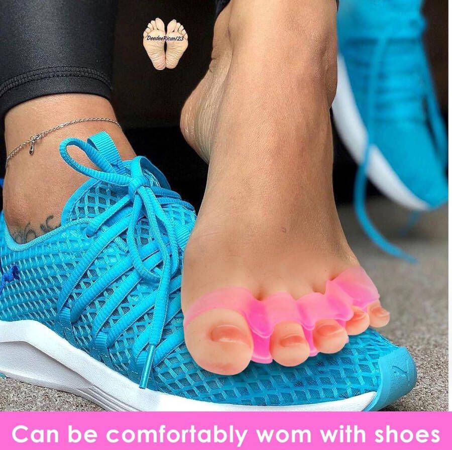 Allecto Plus Siliconen zachte teenslippers voor hallux valgus en hamertenen 4 stuks Teenspreiders en Universele