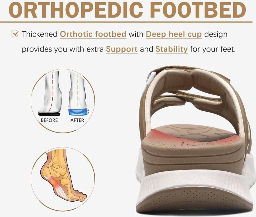 SnelShoppen Dames Orthotische Sandalen Herstel Wandelen Slides met Arch Support voor Plantar Fasciitis Comfortabele Orthopedische Zomer Sandalen B