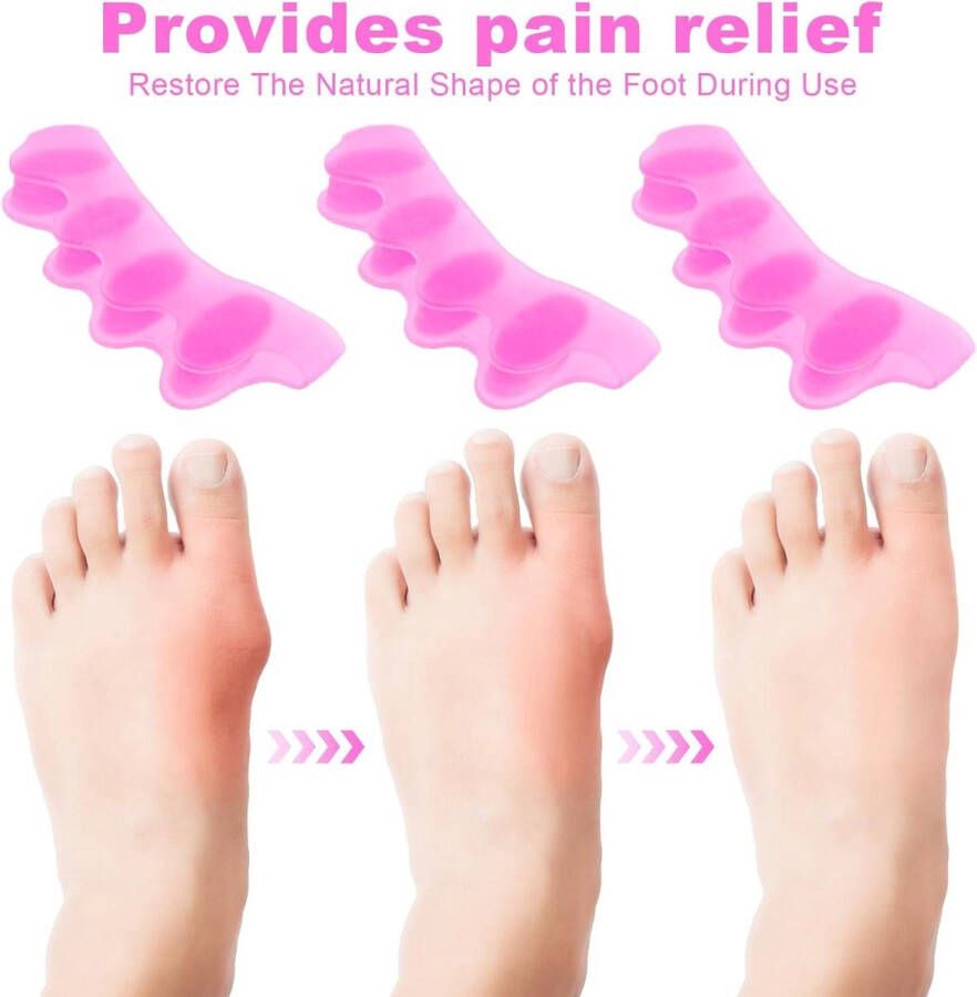 Teenslippers met 4 stuks teenspreiders voor hallux valgus en hamertenen Universele