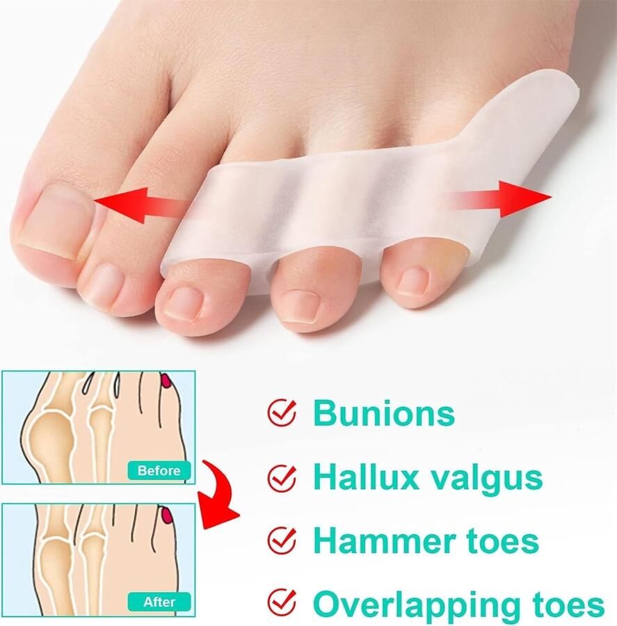 Teenslippers Wit Medische Siliconen Gel Voor nen en