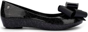 Melissa Ballerina's Ultragirl Sweet XXI Black Glitter